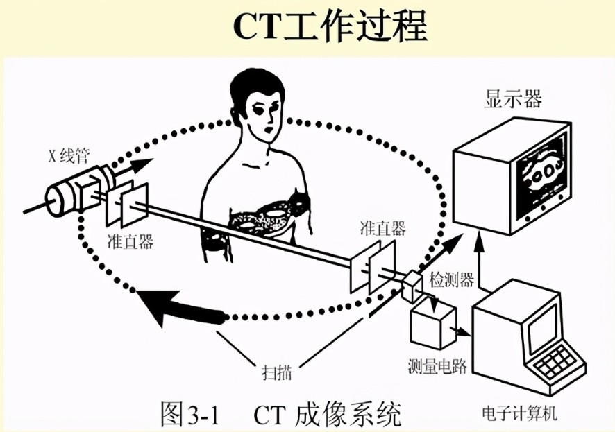 CT掃描儀成像原理