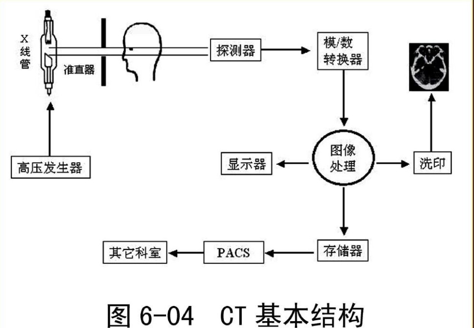 CT結構原理