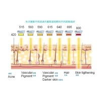 五大光子嫩膚技術(shù)（IPL、DPL、OPT、APT、BBL）及濾光片區(qū)別